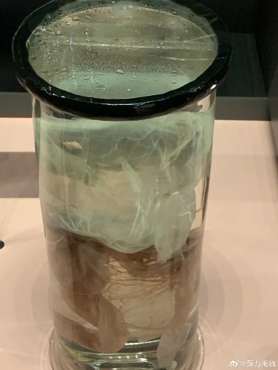 (福尔马林百度百科)福尔马林63集免费！快来体验惊心动魄的剧情