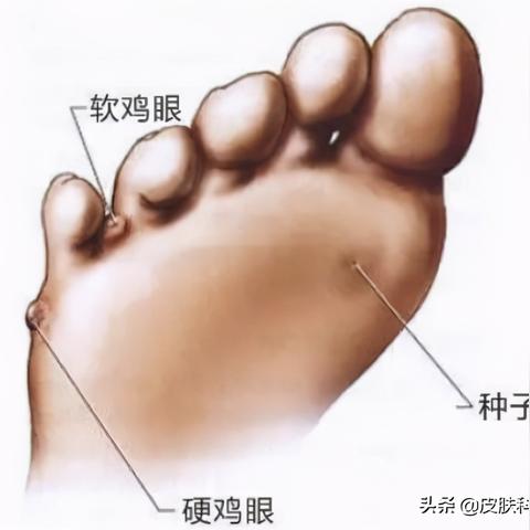 (咪莫特乳膏好用吗)选择优质咪莫特软膏时，哪几个品牌最值得信赖和推荐呢？